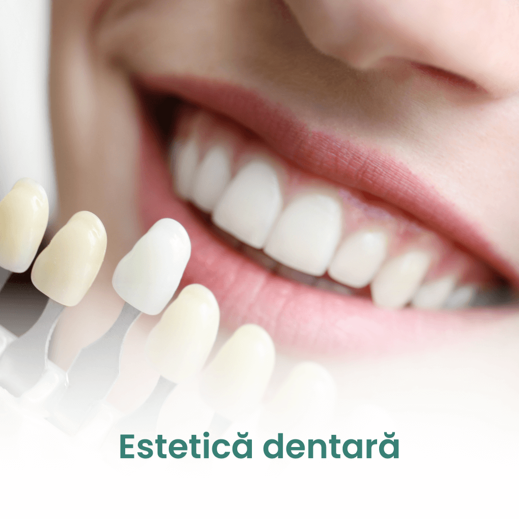 estetica dentara